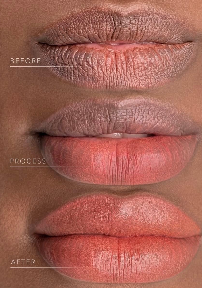 Before, process, and after dark lip neutralization