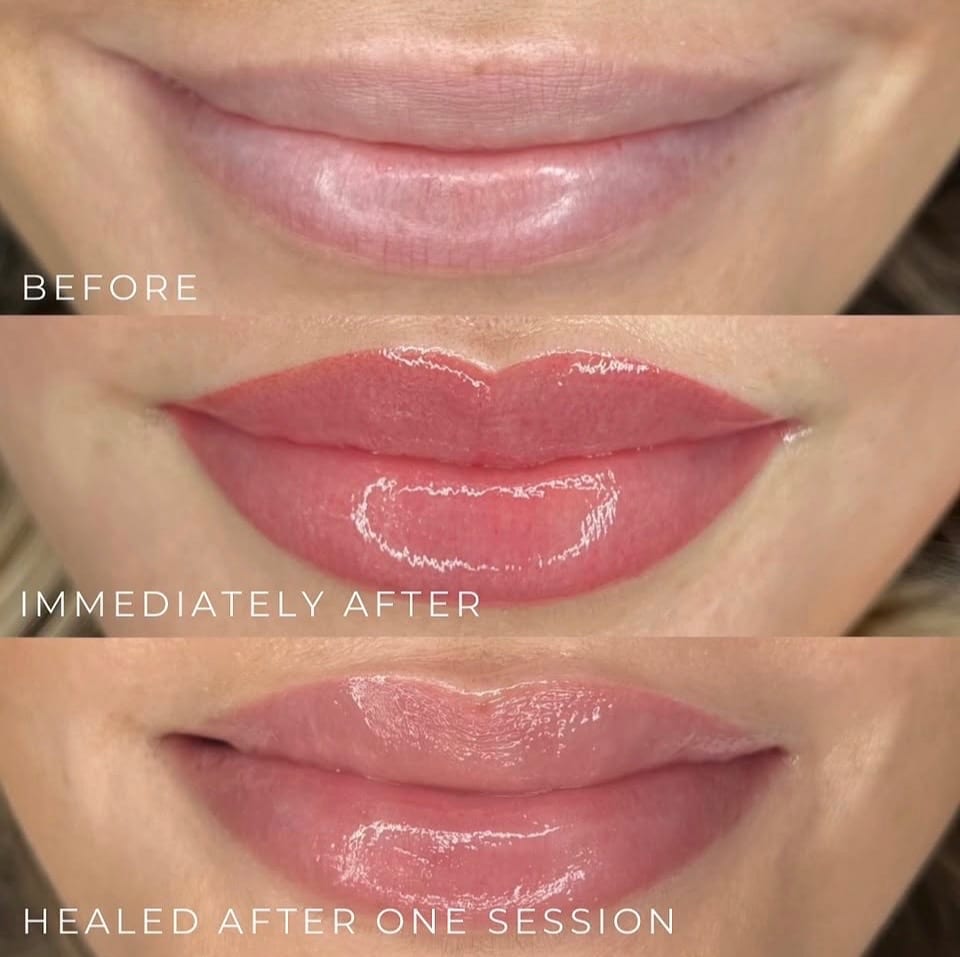 Before, immediately after, and healed lip blush results